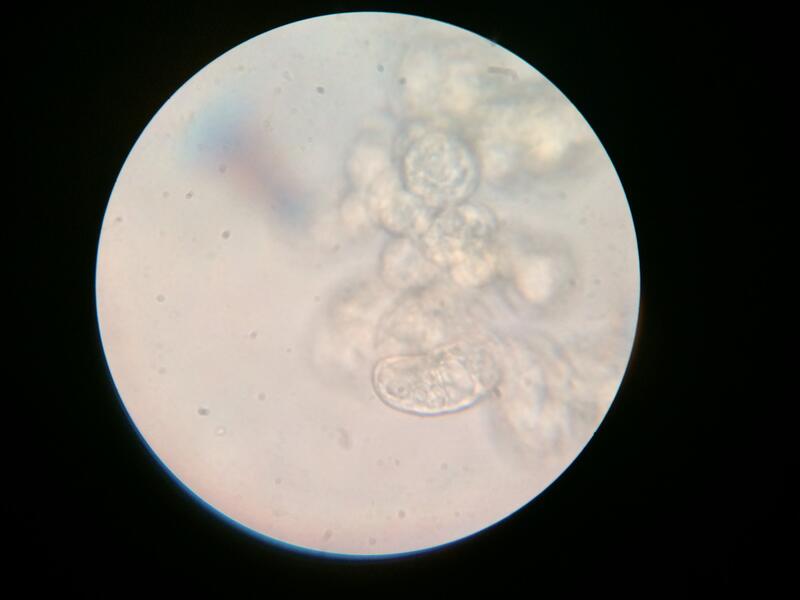 printed Arabadopsis cells