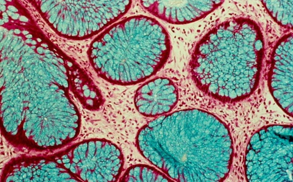 Polyp Cross Section