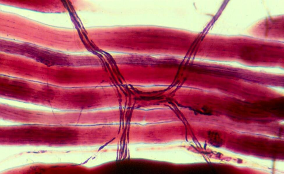 Striated Muscle Tissue