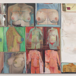 Before After Implant