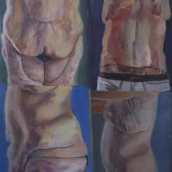 Before After Abdominoplasty