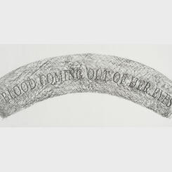 Blood coming out of her eyes