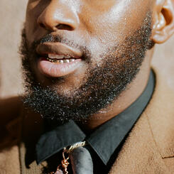 Gold Fronts- Anthony