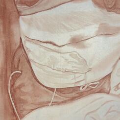 dad (incision with drain)