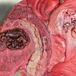 Pleasure in the Confusion of Boundaries I detail