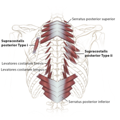 Supra Costalis Type 1 and Type 2 Muscles