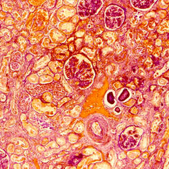 Liver Tissue