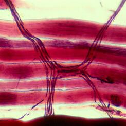 Striated Muscle Tissue
