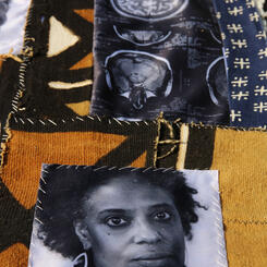 My Mother's Brain Scans