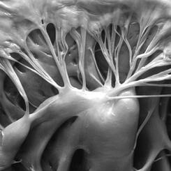 Human Heart, valve and trabeculae