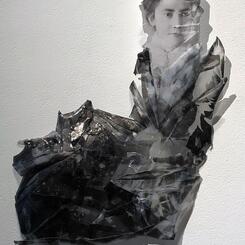 Washerwoman Syndrome 2