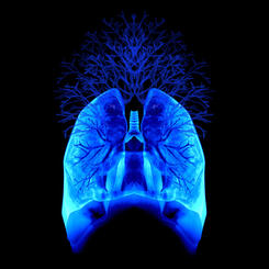 Air Branches: An X-ray image of my lungs, reinterpreted & synthesized with an illustrated windpipe & tree branches by multimedia visual artist Erica Hansen.