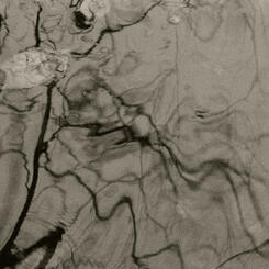 Sympathetic Bodies (still frame) 