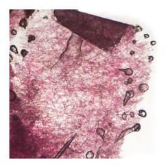 detail projected worry slide