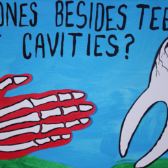 A question about cavities