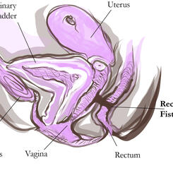 Sample Illustrations from Women's Health Manual 