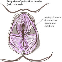 Sample Illustrations from Women's Health Manual 