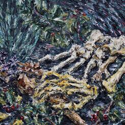 Skeletal Hand and Foot