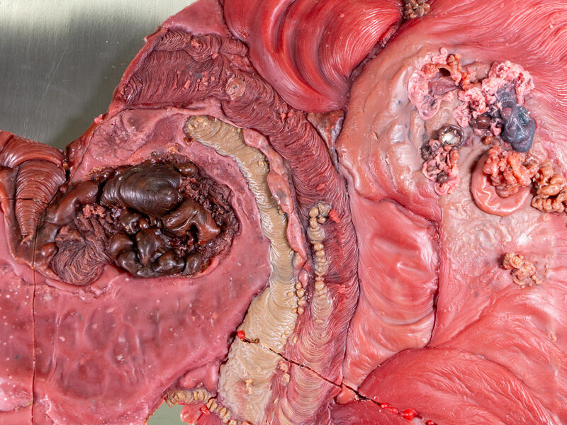 Pleasure in the Confusion of Boundaries I detail