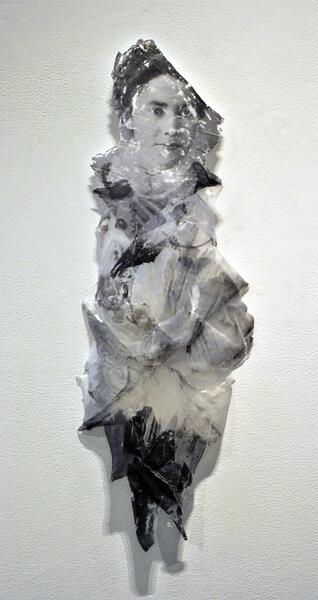 Washerwoman Syndrome 4