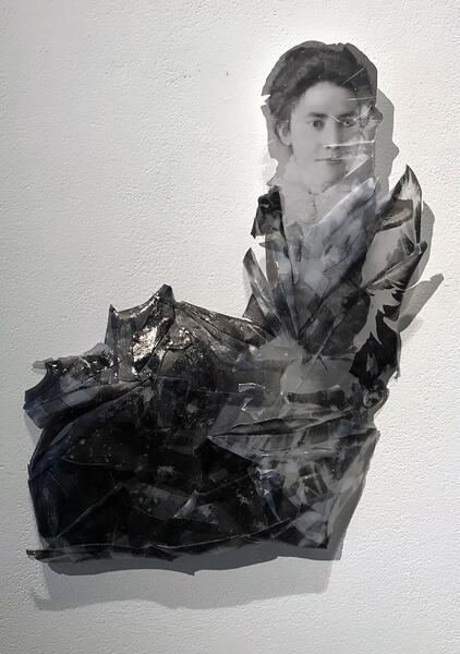 Washerwoman Syndrome 2