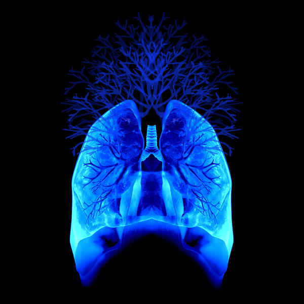 Air Branches: An X-ray image of my lungs, reinterpreted & synthesized with an illustrated windpipe & tree branches by multimedia visual artist Erica Hansen.