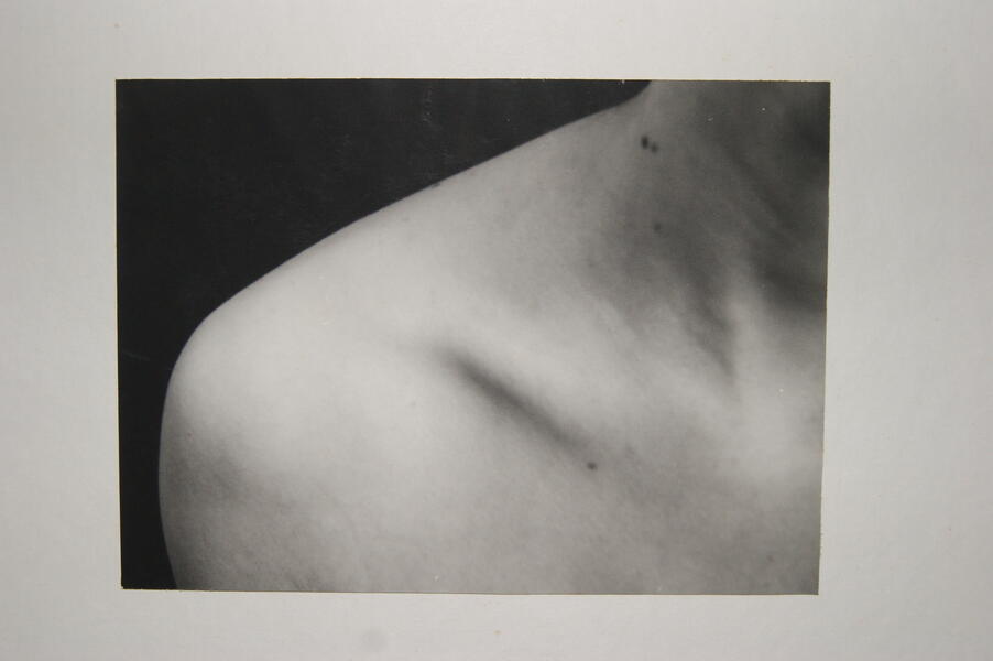 clavicle, charged