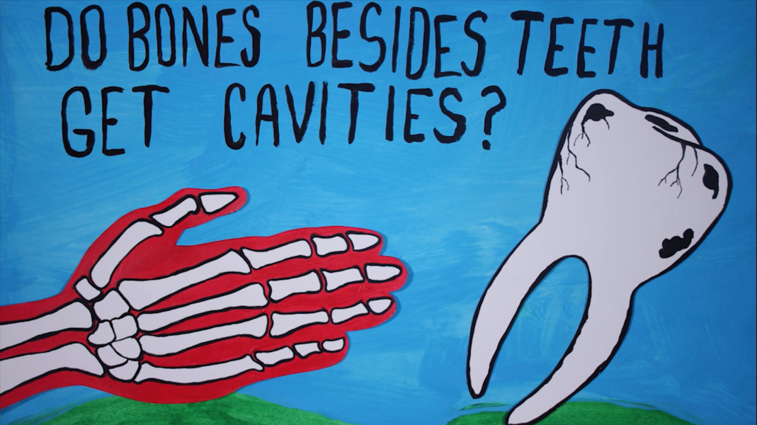 Do bones besides teeth get cavities?
